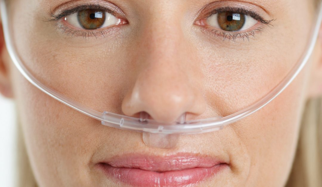 nasal catheter oxygen therapy